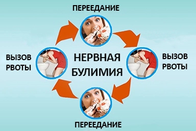 Лечение булимии в Чурапче